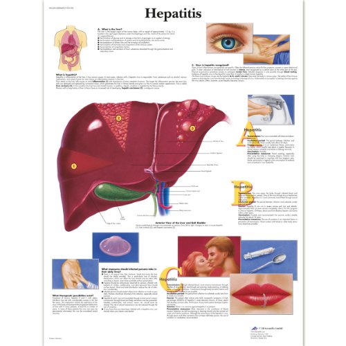 3B Scientific Human Anatomy- Hepatitis-Diagramm, laminierte Version 3B Scientific Human Anatomy- Hepatitis-Diagramm, laminierte Version von 3B Scientific
