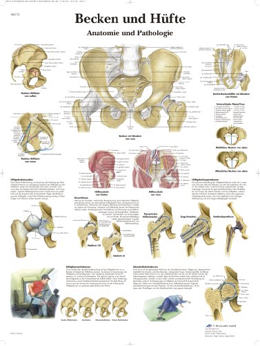 3B Scientific Lehrtafel - Becken und Hüfte - Anatomie und Pathologie, VR0172UU von 3B Scientific