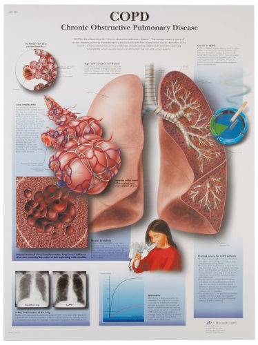 3B Scientific Lehrtafel CHRONISCH obstruktive lungenerkrankung, unlaminated von 3B Scientific