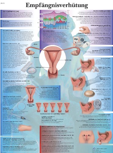 3B Scientific Lehrtafel - Empfängnisverhütung von 3B Scientific