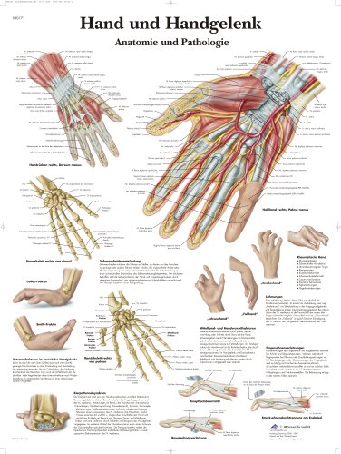 3B Scientific Lehrtafel - Hand und Handgelenk - Anatomie und Pathologie, VR0171UU von 3B Scientific