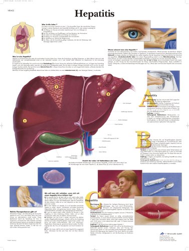 3B Scientific Lehrtafel - Hepatitis von 3B Scientific