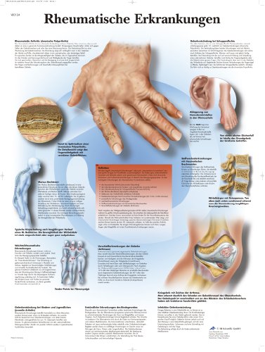 3B Scientific Lehrtafel - Rheumatische Erkrankungen von 3B Scientific