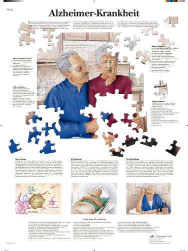3B Scientific Lehrtafel laminiert - Alzheimer-Krankheit von 3B Scientific