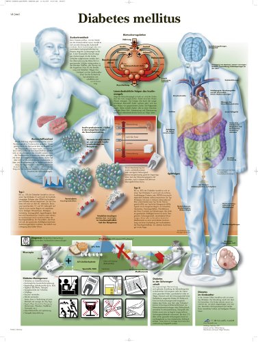 3B Scientific Lehrtafel laminiert - Diabetes melllitus von 3B Scientific