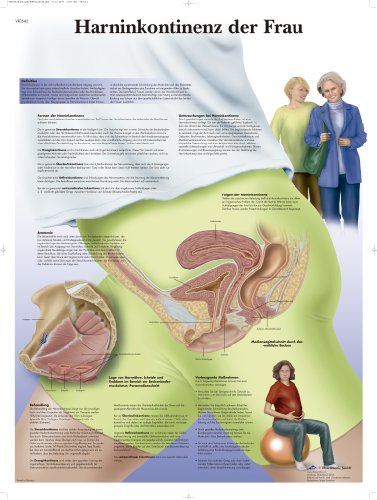 3B Scientific Lehrtafel laminiert - Harninkontinenz der Frau von 3B Scientific