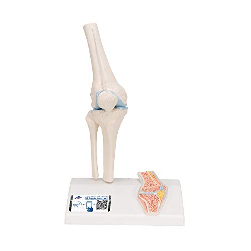 3B Scientific Menschliche Anatomie - Mini-Kniegelenkmodell mit Querschnitt + kostenlose Anatomie App - 3B Smart Anatomy, A85/1 von 3B Scientific