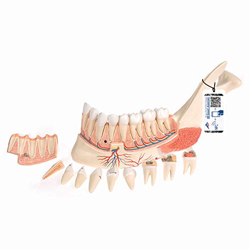 3B Scientific Menschliche Anatomie - Unterkieferhälfte mit 8 kariösen Zähnen, 19-teilig + kostenlose Anatomie App - 3B Smart Anatomy 3B Scientific Menschliche Anatomie - Unterkieferhälfte mit 8 kariösen Zähnen, 19-teilig + kostenlose Anatomie App - 3B Smart Anatomy von 3B Scientific