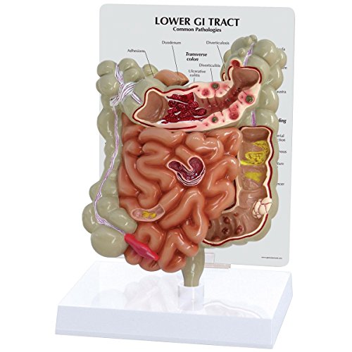 GPI Anatomicals 3342 Magen-Darm Trakt Modell, 1019556 von 3B Scientific