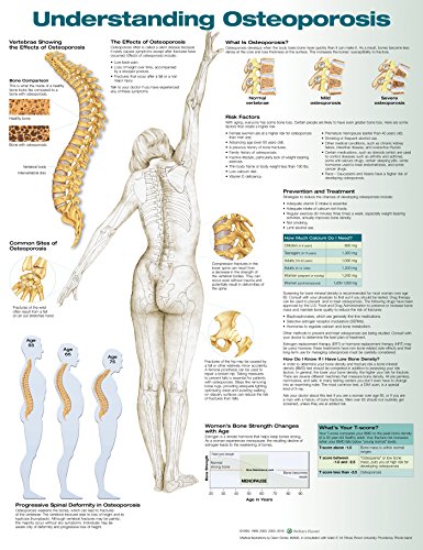 Understanding Osteoporosis von ACC