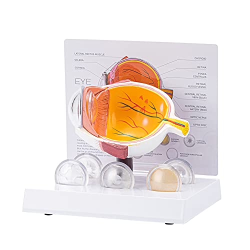 AISITESY Cornea Augapfel Modell Menschliches Auge Modell Menschliches Auge Demonstration Lehre Requisite Katarakt Anatomie Medizinisches Lehrmodell AISITESY Cornea Augapfel Modell Menschliches Auge Modell Menschliches Auge Demonstration Lehre Requisite Katarakt Anatomie Medizinisches Lehrmodell von AISITESY
