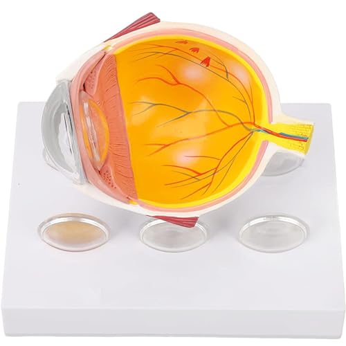 AMITD Augapfelmodell zeigt Sehnerven Anatomisches Modell des Bildungsauges Erweiterte Operationsanzeige für Katarakt AMITD Augapfelmodell zeigt Sehnerven Anatomisches Modell des Bildungsauges Erweiterte Operationsanzeige für Katarakt von AMITD