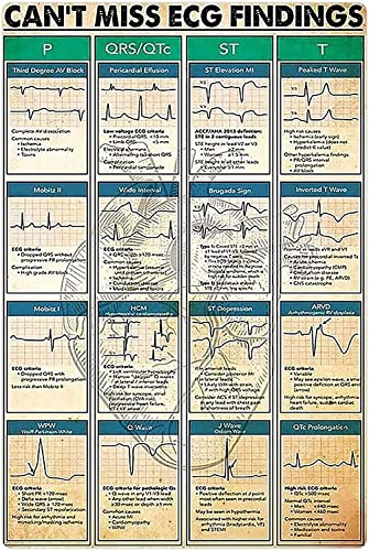 AXHNG Vintage ECG Knowledge Can't Miss ECG Findings Cardiologen Guide Krankenhaus Klinik Offic Science Poster Metall Aluminium Blechschild 20,3 x 15,2 cm Wanddekoration von AXHNG