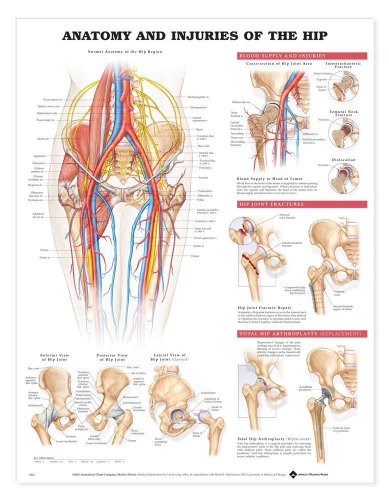 Anatomieposter mit Aufschrift „Anatomy and Injuries of the Hip“ (englische Version) von Anatomical Chart