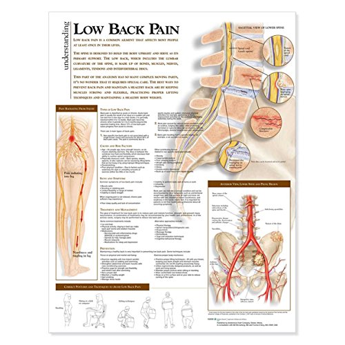 Understanding Low Back Pain Anatomical Chart Understanding Low Back Pain Anatomical Chart von Anatomy Stuff