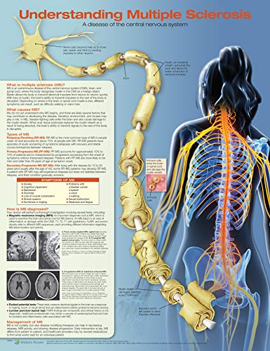 Understanding Multiple Sclerosis von Anatomical Chart