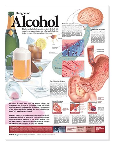 Dangers of Alcohol Anatomical Chart von Anatomy Stuff