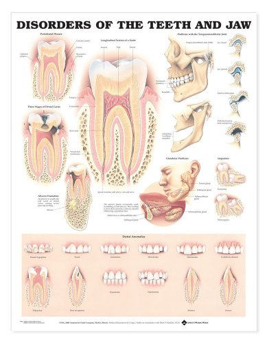 Disorders of the Teeth and Jaw Anatomical Chart Disorders of the Teeth and Jaw Anatomical Chart von Anatomy Stuff