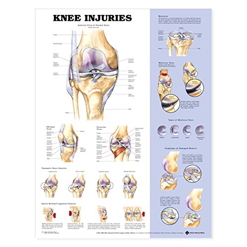 Knee Injuries Anatomical Chart von Anatomy Stuff