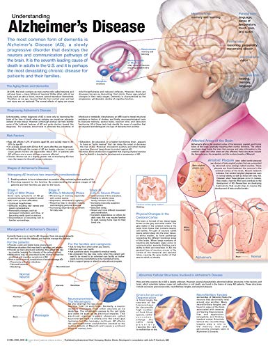 Understanding Alzheimer's Disease Anatomical Chart von Anatomy Stuff
