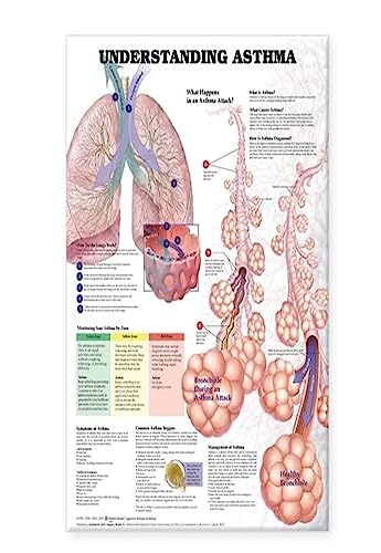 Understanding Asthma Anatomical Chart von Anatomy Stuff
