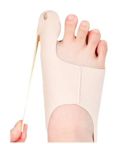 1 Paar Ergonomisches Hallux Valgus Korrektur, Wissenschaftlich Proportionierte Stoffe Zehenspreizer Hallux Valgus, Täglicher Gebrauch Hallux Valgus Schiene Unisex (1, color de piel, L) von Aomhrek