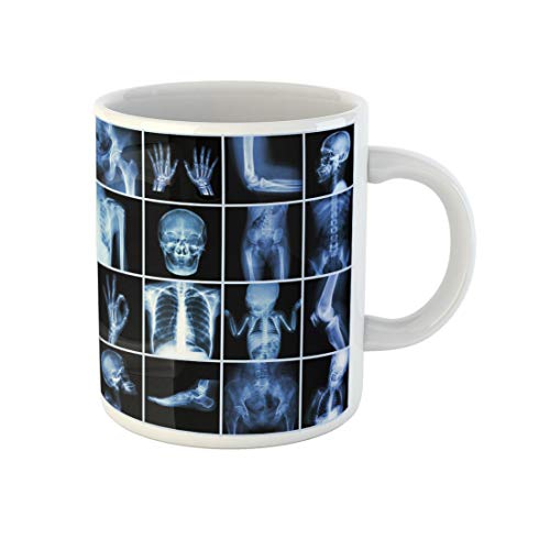 Awowee Ray Collection Kaffeetasse aus der Ray-Kollektion, mehrere Teile des menschlichen Röntgenknochen-Krankenhauses, 325 ml, tolles Geschenk oder Souvenir für Familie, Freunde, Kollegen von Awowee