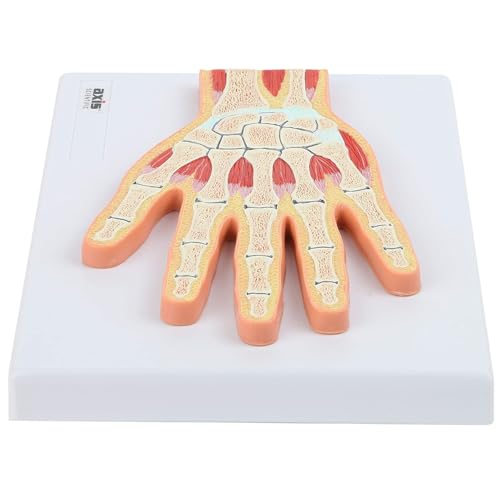 Anatomisches Modell der Skelettmuskelstruktur des Handgelenks, verwendet in der medizinischen Lehre und der Arzt-Patienten-Kommunikation Anatomisches Modell der Skelettmuskelstruktur des Handgelenks, verwendet in der medizinischen Lehre und der Arzt-Patienten-Kommunikation von CHENHOJU