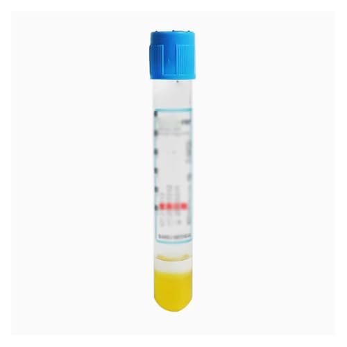 Blutröhrchen, 8 ml, Behälter mit separatem Gel-Blutröhrchen-KIT(12PCS PRP Tube) von CHUIXISH