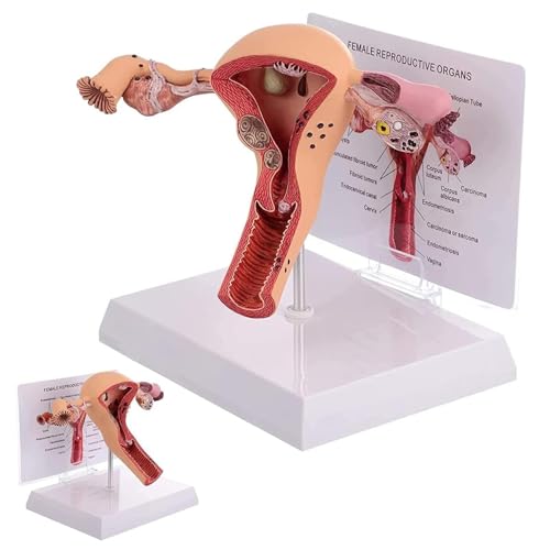 Modell der weiblichen Gebärmutter, Modell der pathologischen Gebärmutter, Modell der weiblichen Geschlechtsorgane, Anatomische Modelle der menschlichen Gebärmutter mit Lehrkarte und Sockel Modell der weiblichen Gebärmutter, Modell der pathologischen Gebärmutter, Modell der weiblichen Geschlechtsorgane, Anatomische Modelle der menschlichen Gebärmutter mit Lehrkarte und Sockel von COUCHO