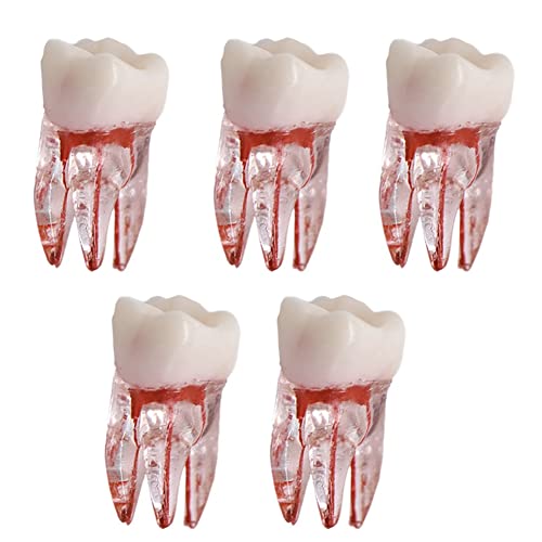 5 Stück Dentalzahn-Wurzelkanal-Modell für RCT-Praxis Pulp Cavity Clear Resin Individueller Zahn für Dental Dtudy-Modell von Chestnut-YX