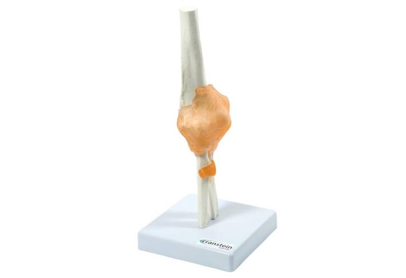 Cranstein Scientific Dekoobjekt Ellbogen Anatomie Modell lebensgroß mit Ligamenten auf Stativ Cranstein Scientific Dekoobjekt Ellbogen Anatomie Modell lebensgroß mit Ligamenten auf Stativ von Cranstein Scientific