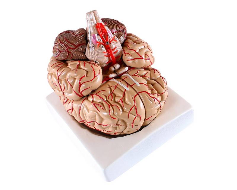 Cranstein Scientific Dekoobjekt Gehirn Anatomie Modell lebensgroß 9 teilig mit Arterien auf Schale Cranstein Scientific Dekoobjekt Gehirn Anatomie Modell lebensgroß 9 teilig mit Arterien auf Schale von Cranstein Scientific