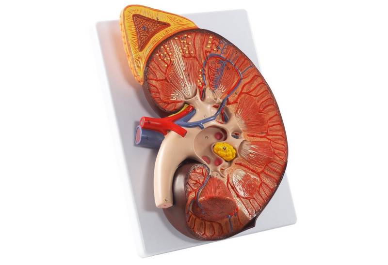 Cranstein Scientific Dekoobjekt Niere mit Nebenniere Anatomie Modell 2 teilig 3x vergrößert auf Sockel Cranstein Scientific Dekoobjekt Niere mit Nebenniere Anatomie Modell 2 teilig 3x vergrößert auf Sockel von Cranstein Scientific