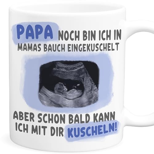 Tasse mit Ultraschallbild zum Schwangerschaft verkünden Du wirst Papa Überraschung Vater personalisierte Fototasse mit eigenem Ultraschall Foto Geschenk (Papa) von DEL MÀ Unique & Personal