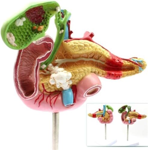 DRFGHK 1:1 Human Pancreas Spleen Duodenum Gallbladder pathological Anatomical Model for Medical Training and Auxiliary Medical Treatment DRFGHK 1:1 Human Pancreas Spleen Duodenum Gallbladder pathological Anatomical Model for Medical Training and Auxiliary Medical Treatment von DRFGHK