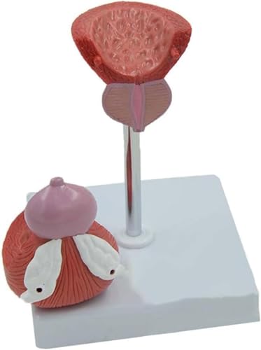 DRFGHK Human Organ Model, Male Prostate & Bladder Anatomical Model, Urinary System Teaching Aid DRFGHK Human Organ Model, Male Prostate & Bladder Anatomical Model, Urinary System Teaching Aid von DRFGHK