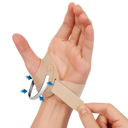 FORTEMOTUS Daumenschiene, CMC Daumenorthese mit Metallhalterung, Stabilisiert das Daumensattelgelenk Bei Arthrose Daumenbasis, Gelenkinstabilität zur Schmerzlinderung (Linke, Haut, S, 16-19 cm) von FORTEMOTUS