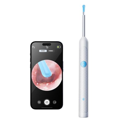 Entfernung von Fiorky Ohrwachs, Smart Visual Ohrreiniger mit Kamera Otoskop -Ohrreiniger wieder aufladbarer Ohrwachsentferner Gesundheitsversorgung Set von Fiorky
