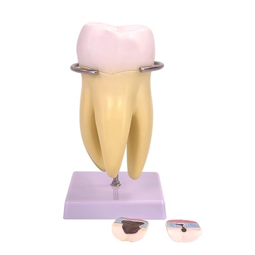 Molar Tooth Model Detachable Tooth Anatomy Model for Display of Scientific Research in Medical and Clinic Settings Molar Tooth Model Detachable Tooth Anatomy Model for Display of Scientific Research in Medical and Clinic Settings von Florisync