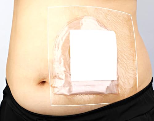 GEDRACKPMYN wasserdichte Stomabeutel-Duschabdeckung, 30 Stück Stoma-Bad Schutzfolie, Selbstklebende Verband Binde (10 x 12) cm von GEDRACKPMYN