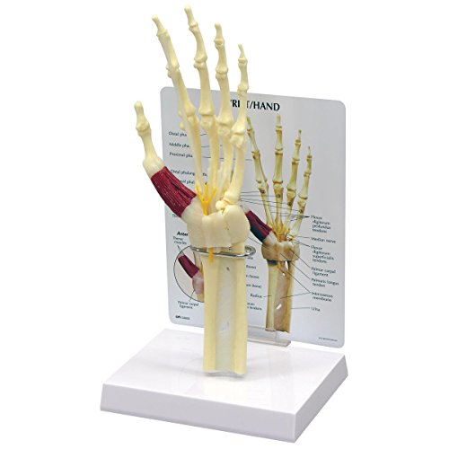 GPI Anatomicals 1920 Hand ModellKarpaltunnelsyndrom von 3B Scientific