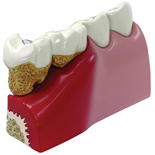 GPI Anatomicals 2860 Zähne Modell GPI Anatomicals 2860 Zähne Modell von 3B Scientific