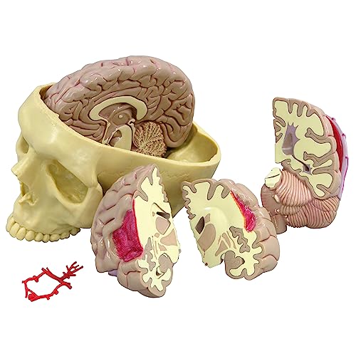 GPI Anatomicals 2900 Gehrin Modell von 3B Scientific