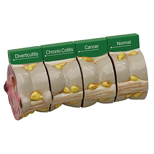 GPI Anatomicals 3341 Dickdarm 4 Scheibenmodell von 3B Scientific