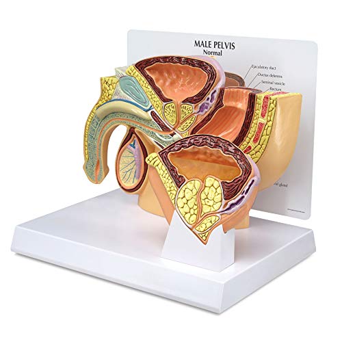 GPI Anatomicals 3552 Becken männlich Modell mit BPH von GPI Anatomicals