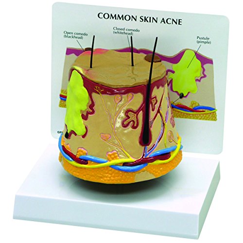 GPI Anatomicals 3750 Haut Modell Akne GPI Anatomicals 3750 Haut Modell Akne von 3B Scientific