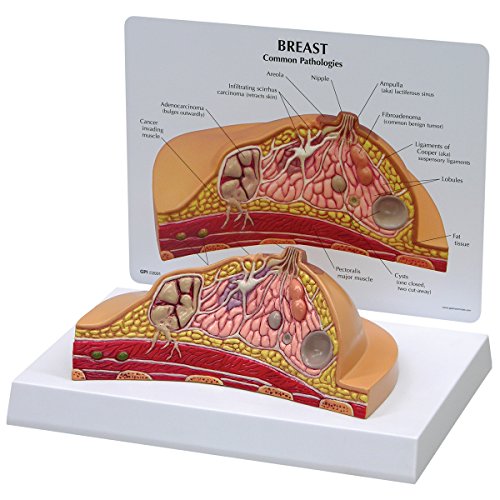 GPI Anatomicals W33351 Brust Modell Querschnitt von 3B Scientific