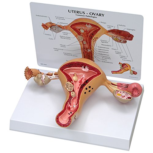 GPI Anatomicals W33352 Uterus Modell GPI Anatomicals W33352 Uterus Modell von 3B Scientific