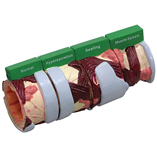 GPI Anatomicals W33362 Bronchie 4 Stadien Modell GPI Anatomicals W33362 Bronchie 4 Stadien Modell von 3B Scientific